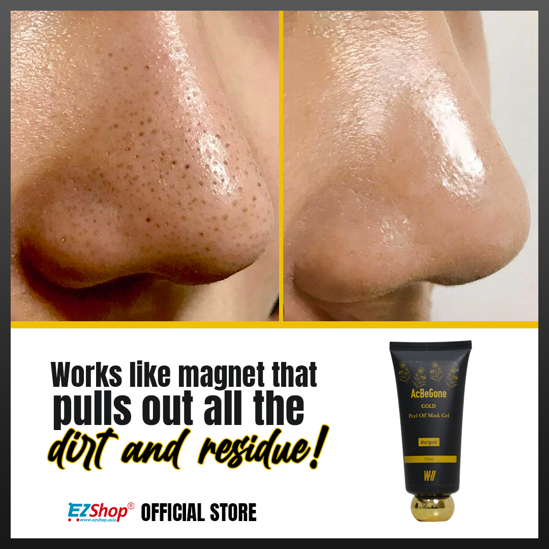 WII Acbegone Peel Off Mask Gel Bundle of 4