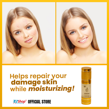 W-II Acbegone Moisturizing Essence Gel Bundle of 4