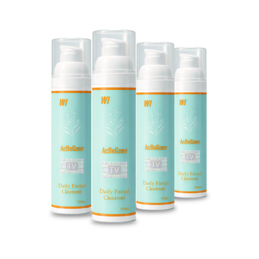 W-II Acbegone Daily Facial Cleanser Bundle of 4