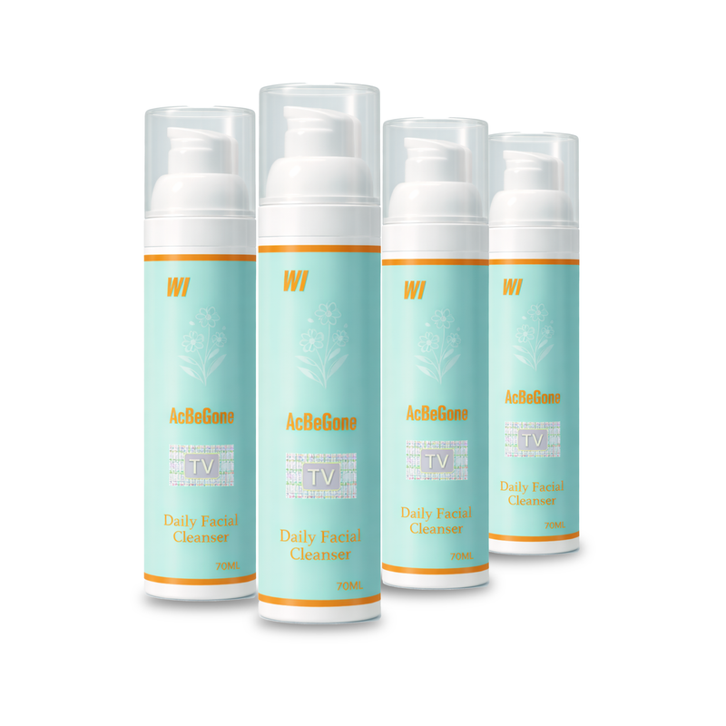W-II Acbegone Daily Facial Cleanser Bundle of 4